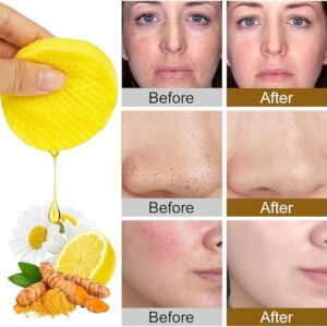 Kwas Kojowy i Kurkuma Płatki Oczyszczające do Twarzy 60Szt, Peeling do - obrazek 3