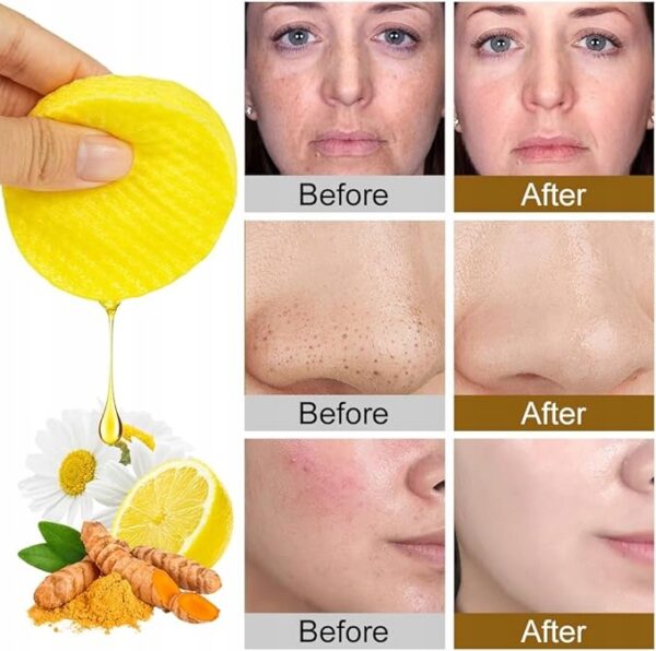 Kwas Kojowy i Kurkuma Płatki Oczyszczające do Twarzy 60Szt, Peeling do